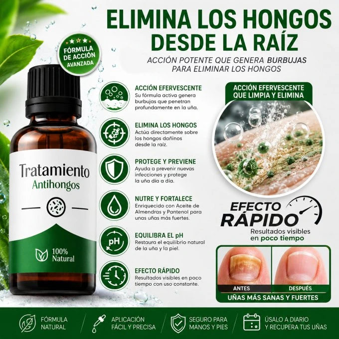 StopHongos®Tratamiento de 60 días para los hongos PAGA 1 LLEVA 2