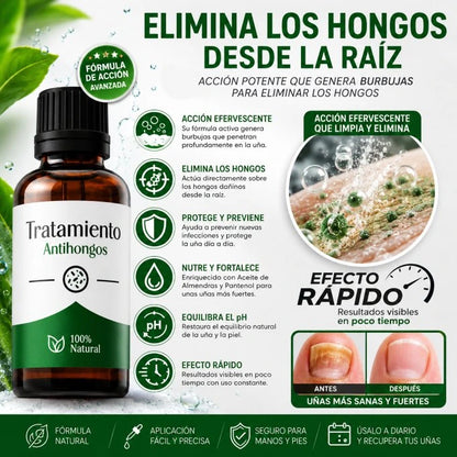 StopHongos®Tratamiento de 60 días para los hongos PAGA 1 LLEVA 2