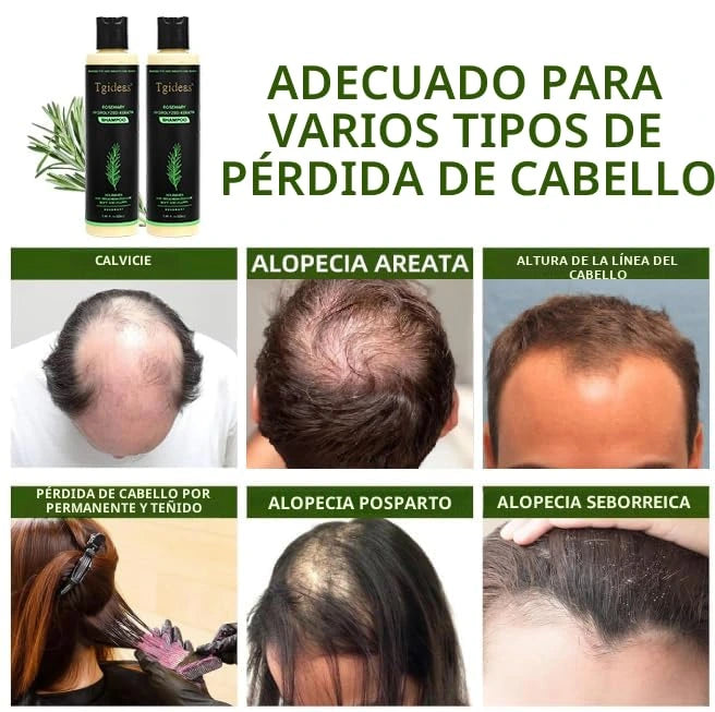 PAGA 1 LLEVA 2 Tgideas® rosemary hydrolized keratin