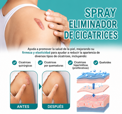 Paga 1 lleva 2 Medical Grade-Eliminación de cicatrices, Spray de grado médico