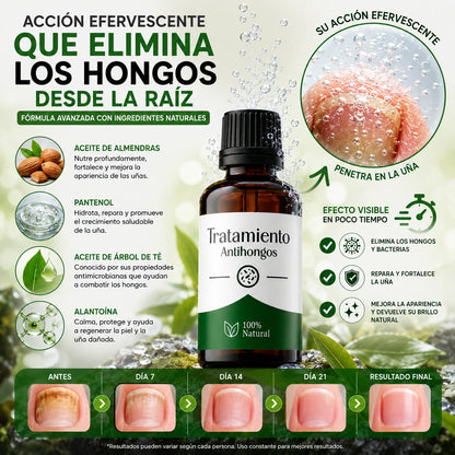 StopHongos®Tratamiento de 60 días para los hongos PAGA 1 LLEVA 2
