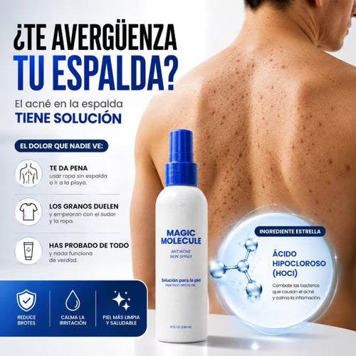 Magic molecule spray para acne en la espalda